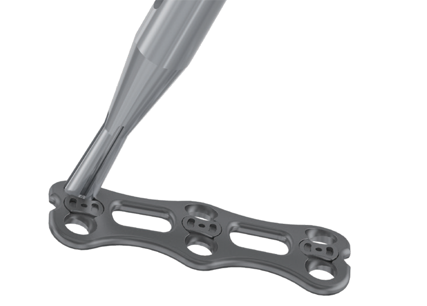 Placa Cervical Anterior CAMIC - Imagen 2