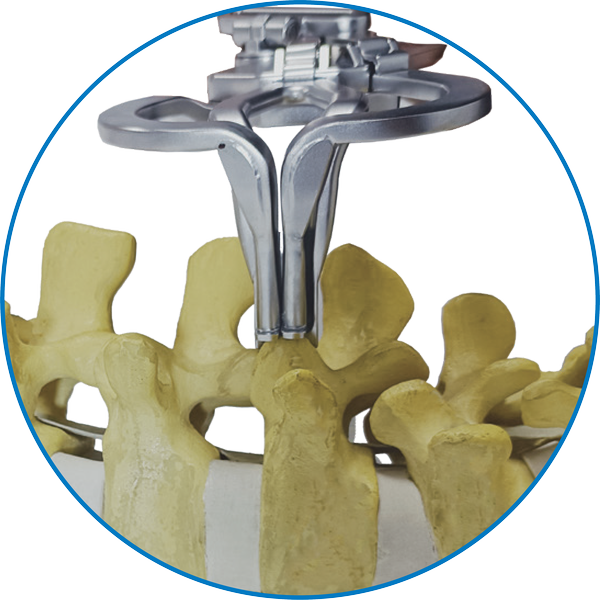 Retractor Lumbar - Imagen 3