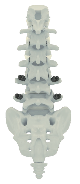 Retractor Cervical - Imagen 2