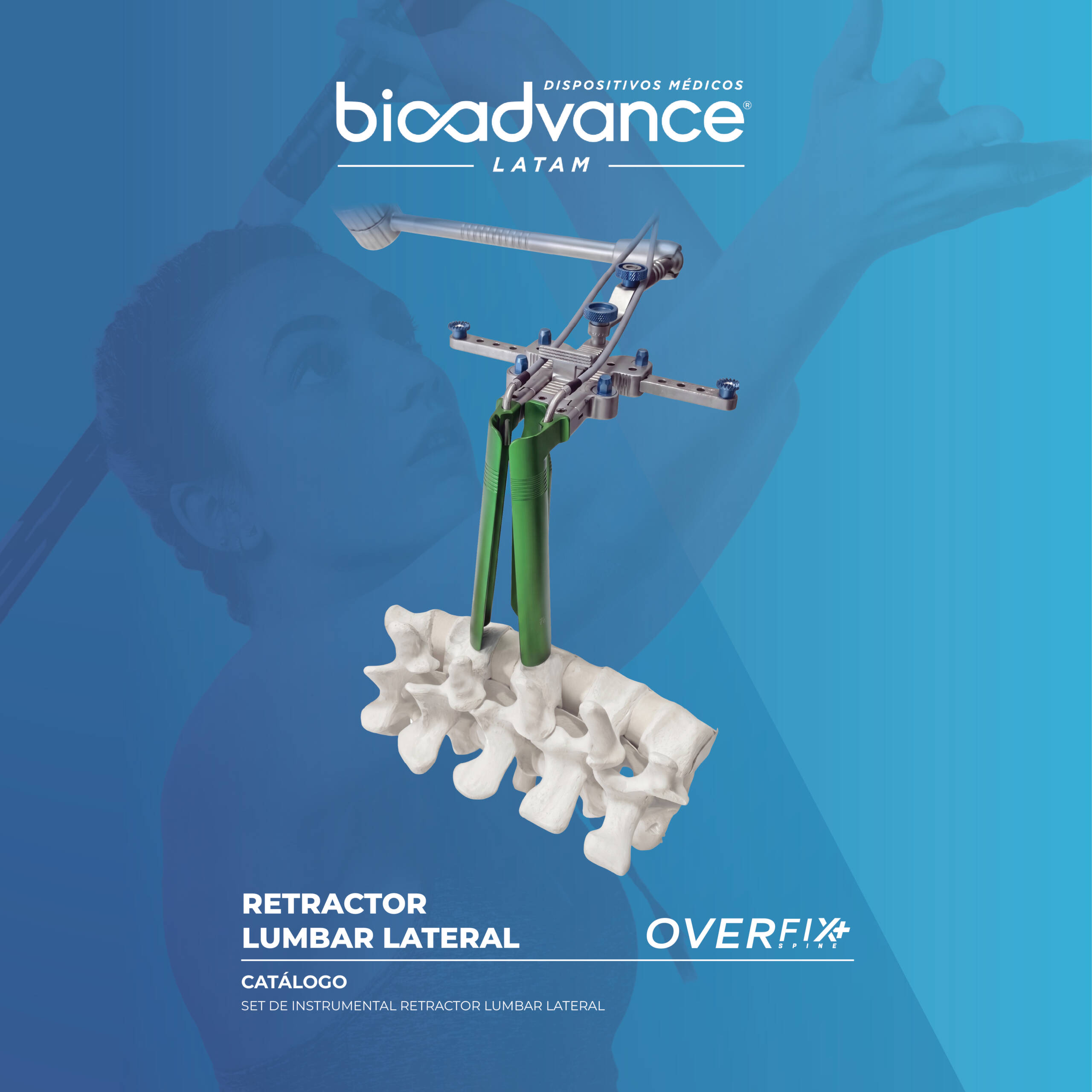 Retractor Lumbar Lateral