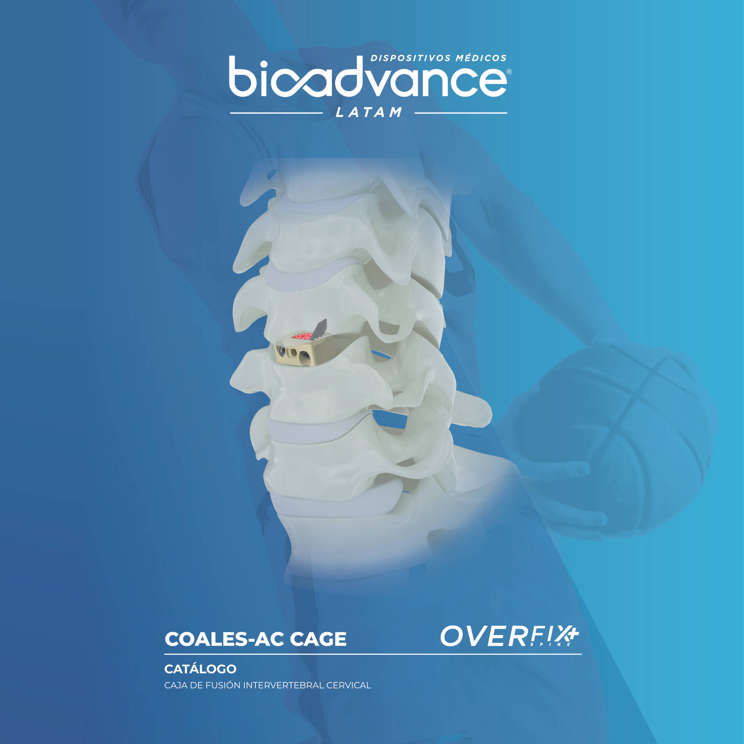 Cervical Cage Coales-AC (2T)