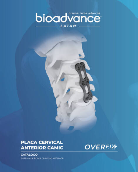 Placa Cervical Anterior CAMIC