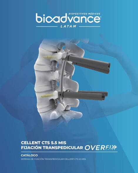 Sistema de Fijación Transpedicular CELLENT CTS 5.5 MIS