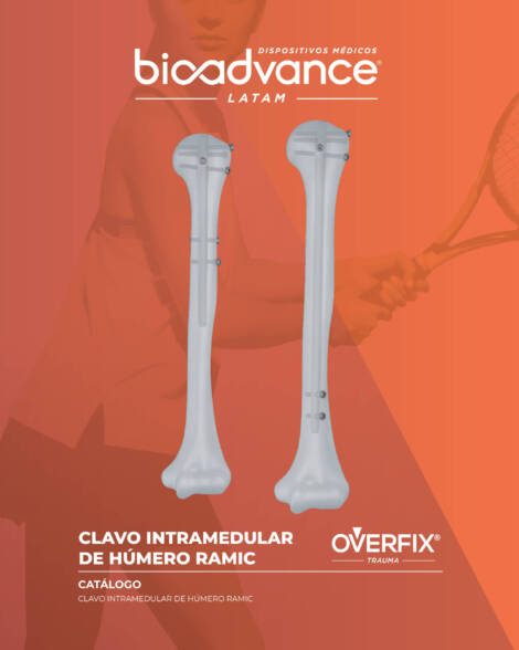 Clavo Intramedular de Húmero RAMIC