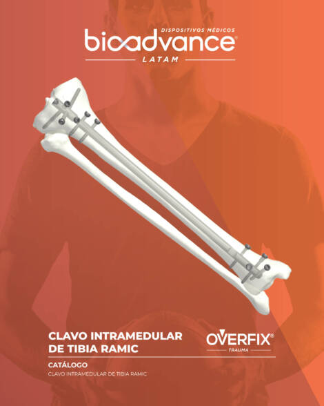 Clavo intramedular de Tibia RAMIC