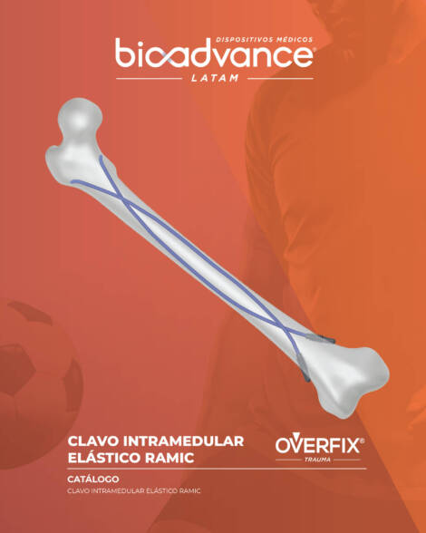 Clavo intramedular de Clavo Elástico RAMIC