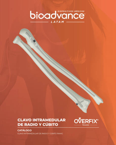Clavo intramedular de Radio y Cúbito