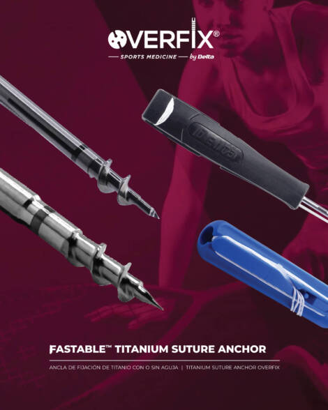 FASTABLE TITANIUM