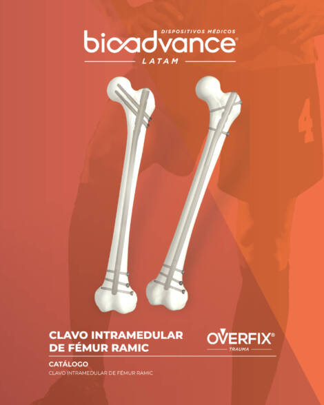 Clavo intramedular de Fémur RAMIC